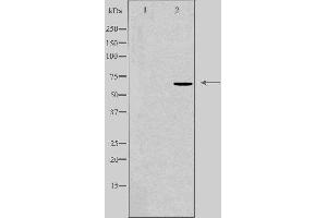Western blot analysis of extracts from HepG2 cells using DDX52 antibody. (DDX52 anticorps  (C-Term))