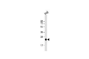 Anti-UQCRFS1 Antibody (C-term) at 1:1000 dilution + Raji whole cell lysate Lysates/proteins at 20 μg per lane.
