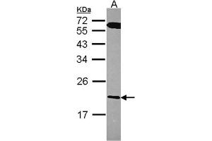 AP31125PU-N RGS10 antibody staining of A431 (Lane A) whole cell lysate (30 µg) at 1/1000 dilution, 12% SDS PAGE. (RGS10 anticorps  (AA 1-160))