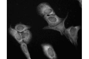Immunofluorescent staining of U-2 OS (ATCC HTB-96) cells.