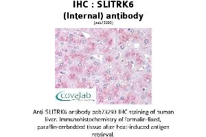Image no. 1 for anti-SLIT and NTRK-Like Family, Member 6 (SLITRK6) (Internal Region) antibody (ABIN1739441) (SLITRK6 anticorps  (Internal Region))