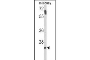 Western blot analysis of SMNDC1 Antibody (N-term) (ABIN653319 and ABIN2842811) in mouse kidney tissue lysates (35 μg/lane). (SMNDC1 anticorps  (N-Term))