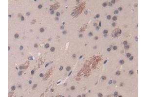 Detection of DARC in Mouse Cerebrum Tissue using Polyclonal Antibody to Duffy Blood Group Chemokine Receptor (DARC)