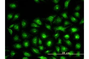 Immunofluorescence of monoclonal antibody to UBE2L3 on HeLa cell. (UBE2L3 anticorps  (AA 1-154))