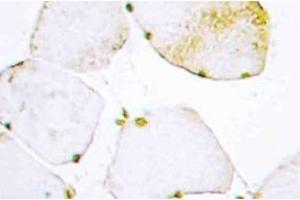 Immunohistochemistry (IHC) analyzes of UDG antibody in paraffin-embedded human skeletal muscle tissue.