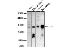 Western blot analysis of extracts of various cell lines, using CLIC4 antibody (ABIN6127638, ABIN6138723, ABIN6138724 and ABIN6222890) at 1:500 dilution. (CLIC4 anticorps  (AA 1-253))