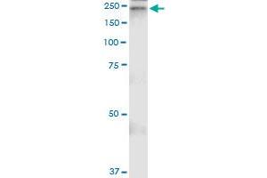 Immunoprecipitation of A2M transfected lysate using anti-A2M MaxPab rabbit polyclonal antibody and Protein A Magnetic Bead , and immunoblotted with A2M purified MaxPab mouse polyclonal antibody (B01P) .