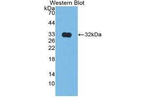 Detection of Recombinant CS, Rat using Polyclonal Antibody to Citrate Synthase (CS)