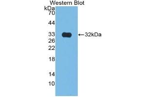 Detection of Recombinant CS, Rat using Polyclonal Antibody to Citrate Synthase (CS) (CS anticorps  (AA 56-312))