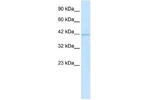 WB Suggested Anti-HOXA10 Antibody Titration:  1. (HOXA10 anticorps  (N-Term))