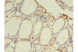 Immunohistochemistry of paraffin-embedded human thyroid tissue using ABIN7172278 at dilution of 1:100 (TLR6 anticorps  (AA 32-586))