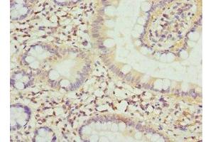 Immunohistochemistry of paraffin-embedded human small intestine tissue using ABIN7152794 at dilution of 1:100 (FGF19 anticorps  (AA 25-216))