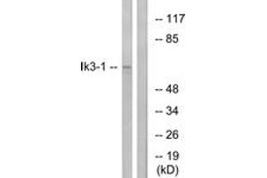 Western blot analysis of extracts from LOVO cells, using Ik3-1 Antibody. (CABLES1 anticorps  (AA 561-610))