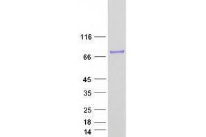 Validation with Western Blot