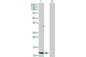 Western Blot analysis of CST1 expression in transfected 293T cell line by CST1 MaxPab polyclonal antibody. (CST1 anticorps  (AA 1-141))