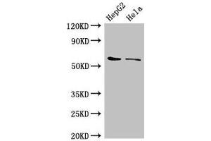 Western Blot Positive WB detected in: HepG2 whole cell lysate, Hela whole cell lysate All lanes: CDT1 antibody at 3 μg/mL Secondary Goat polyclonal to rabbit IgG at 1/50000 dilution Predicted band size: 61 kDa Observed band size: 61 kDa (CDT1 anticorps  (AA 12-170))