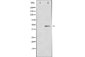 Western blot analysis of GATA4 expression in Serum treated COLO205 whole cell lysates,The lane on the left is treated with the antigen-specific peptide. (GATA4 anticorps  (Internal Region))