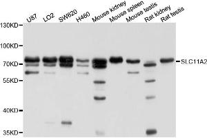 Western blot analysis of extracts of various cell lines, using SLC11A2 antibody (ABIN4905173) at 1:1000 dilution. (SLC11A2 anticorps)