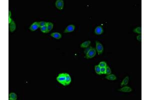 Immunofluorescent analysis of HepG2 cells using ABIN7156651 at dilution of 1:100 and Alexa Fluor 488-congugated AffiniPure Goat Anti-Rabbit IgG(H+L)