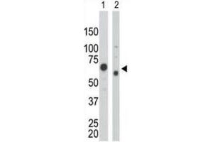 Western Blotting (WB) image for anti-Pyruvate Kinase (PK) antibody (ABIN2995247) (Pyruvate Kinase anticorps)