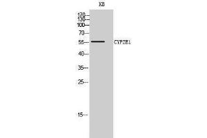 Western Blotting (WB) image for anti-Cytochrome P450, Family 2, Subfamily E, Polypeptide 1 (CYP2E1) (C-Term) antibody (ABIN3174658) (CYP2E1 anticorps  (C-Term))