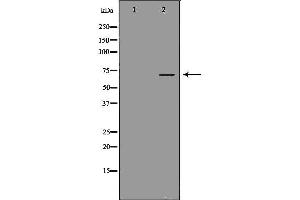 Western blot analysis of extracts of human liver cancer tissue lysate, using DBH antibody.