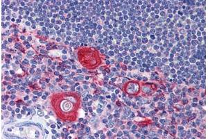 Human Thymus: Formalin-Fixed, Paraffin-Embedded (FFPE) (SNAPIN anticorps  (AA 41-137))