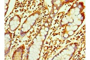 Immunohistochemistry of paraffin-embedded human small intestine tissue using ABIN7167347 at dilution of 1:100