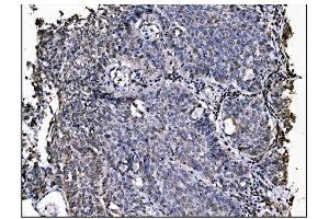 IHC analysis of NDE1 using anti-NDE1 antibody (ABIN7602401).