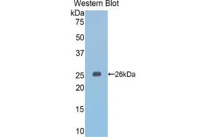 Western blot analysis of the recombinant protein. (SLIT3 anticorps  (AA 1348-1517))