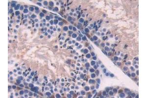 Detection of ADK in Mouse Testis Tissue using Polyclonal Antibody to Adenosine Kinase (ADK)