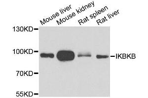 Western blot analysis of extracts of various cell lines, using IKBKB antibody. (IKBKB anticorps  (AA 517-756))