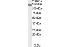 ABIN184611 staining (1 ug/ml) of Human Brain (hippocampus) lysate (RIPA buffer, 30 ug total protein per lane). (TRPM7 anticorps  (C-Term))