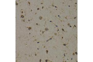 Immunohistochemistry of paraffin-embedded mouse brain using EEF1D antibody (ABIN3023318, ABIN3023319, ABIN3023320 and ABIN6219589) at dilution of 1:200 (40x lens).
