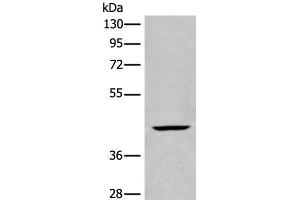 Western blot analysis of Human kidney tissue lysate using BBOX1 Polyclonal Antibody at dilution of 1:650 (BBOX1 anticorps)