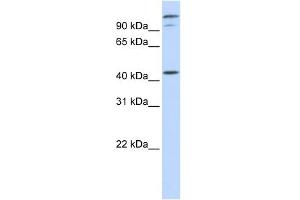 WB Suggested Anti-AFG3L2 Antibody Titration:  0. (AFG3L2 anticorps  (Middle Region))