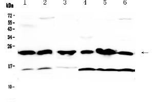 Western blot analysis of GST3 / GST pi using anti-GST3 / GST pi antibody . (GSTP1 anticorps  (AA 2-210))