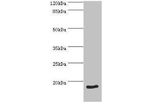 Western blot analysis of HeLa whole cell lysate, using NT-proBNP antibody (2 μg/ml). (NT-ProBNP anticorps  (AA 27-102))