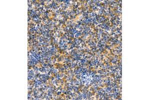Immunohistochemistry of paraffin embedded rat lymph node using CD30 (ABIN7076073) at dilution of 1:600 (400x lens) (TNFRSF8 anticorps)