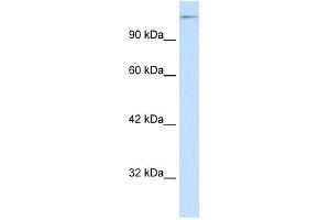 WB Suggested Anti-SUPT5H Antibody Titration: 0. (SUPT5H anticorps  (C-Term))