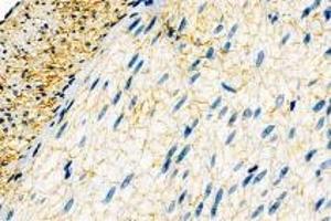 Immunohistochemistry analysis of paraffin-embedded rat intestine using,DMPK (ABIN7073790) at dilution of 1: 2000