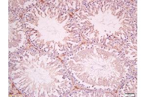 Formalin-fixed and paraffin embedded rat testis tissue labeled with Anti-SOAT1 Polyclonal Antibody, Unconjugated 1:400 followed by conjugation to the secondary antibody and DAB staining.
