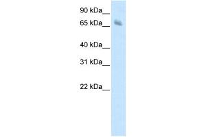 WB Suggested Anti-KBTBD10 Antibody Titration:  1.