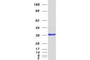 Validation with Western Blot