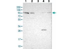 Western blot analysis of Lane 1: RT-4, Lane 2: U-251 MG, Lane 3: Human Plasma, Lane 4: Liver, Lane 5: Tonsil with CDH26 polyclonal antibody . (CDH26 anticorps)