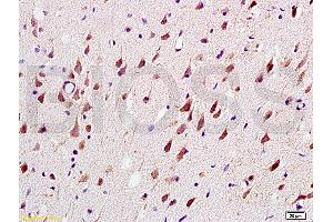 Formalin-fixed and paraffin embedded: rat brain tissue labeled with Anti-MAG-a/L-MAG Polyclonal Antibody (ABIN726935), Unconjugated at 1:200, followed by conjugation to the secondary antibody and DAB staining (MAG anticorps  (AA 551-626))