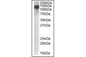 Image no. 1 for anti-ATP-Dependent RNA Helicase A (DHX9) (Internal Region) antibody (ABIN375159) (DHX9 anticorps  (Internal Region))