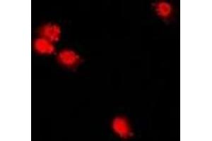 Immunofluorescent analysis of CHRAC17 staining in U2OS cells.