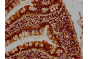 IHC image of ABIN7139855 diluted at 1:400 and staining in paraffin-embedded human small intestine tissue performed on a Leica BondTM system.