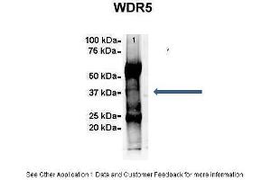 Amount and Sample Type :  500 ug Human NT2 cell lysate  Amount of IP Antibody :  6 ug  Primary Antibody :  WDR5  Primary Antibody Dilution :  1:500  Secondary Antibody :  Goat anti-rabbit Alexa-Fluor 594  Secondary Antibody Dilution :  1:5000  Gene Name :  WDR5  Submitted by :  Dr. (WDR5 anticorps  (C-Term))